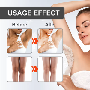 Crema di candeggina di neve parte privata sotto le ascelle lozione sbiancante all'ingrosso marca privata 30ml liquido bianco adulti femmina OEM interno/ODM - Product Image 4