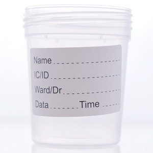 Gobelet de prélèvement d'urine 60 ml avec bouchon à vis en polypropylène, gobelet d'échantillon jetable pour usage médical - Product Image 3
