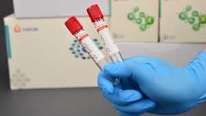 Xét nghiệm chẩn đoán phát hiện sơ tán thu gom máu ống kích hoạt cục máu đông phòng thí nghiệm y tế - Product Image 5