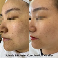 7 Coffrets de Poudre Bio-Microneedling aux Spicules d'Algues Vertes et Sérum Booster Anti-Taches à l'Acide Tranexamique pour l'Élimination de la Pigmentation