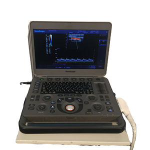 Échographe portable Sonoscape, fonction Doppler, <span class=keywords><strong>scanner</strong></span> portable Sonoscape <span class=keywords><strong>Ultrasonic</strong></span> X3 - Product Image 1
