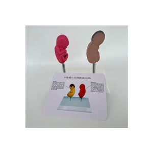 Comparaison des sciences médicales Modèle de maladie de pathologie de malformation fœtale humaine Modèle de maladie d'organe Modèle anti-drogue - Product Image 1