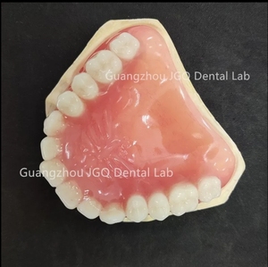 Las dentaduras postizas de boca completa personalizadas, los dientes acrílicos ofrecen una estabilidad mejorada para masticar, comer y hablar con un precio asequible - Product Image 4