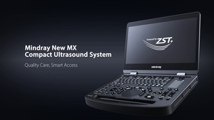 Ecógrafo Veterinario Digital Mindray MX6 con Doppler Color 3D 4D, Precio Competitivo para Uso Veterinario - Product Image 5