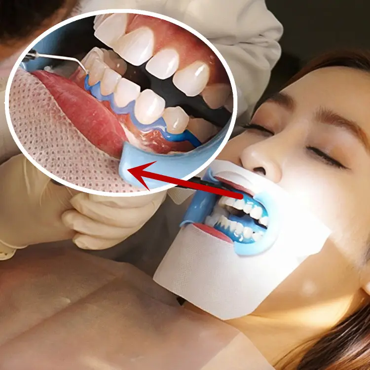 2024 OEM 3ML Dentist Clinic Dental Whitening Gum Protector Gel Gingival Protective Barrier Gel Teeth Whitening Gum Protector
