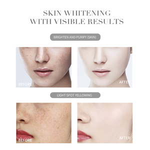 <span class=keywords><strong>Limpiador</strong></span> Aclarador y refrescante Lavado <span class=keywords><strong>facial</strong></span> <span class=keywords><strong>Limpiador</strong></span> de piel para la cara - Product Image 5