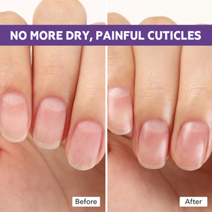 Huile revitalisante et crème fortifiante pour cuticules et ongles, soin personnel sous marque privée, kit anti-fongique pour la croissance des ongles - Product Image 5
