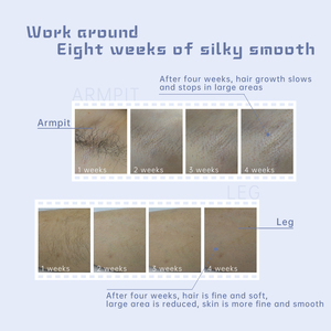 MLAY T4 Dispositivo Professionale per Epilazione IPL con Display LCD <span class=keywords><strong>Epilatore</strong></span> Laser Permanente per <span class=keywords><strong>Donne</strong></span> Zona Bikini Viso Corpo Uso Domestico UK/US - Product Image 4