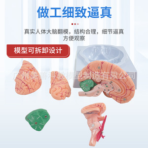 Modèle de cerveau humain, modèle de vaisseaux sanguins cérébraux, modèle d'anatomie du cerveau, modèle pédagogique médical de crâne humain (peut être démonté) - Product Image 2