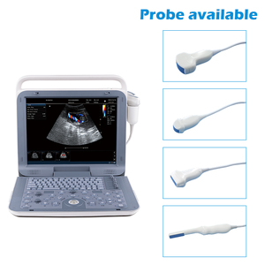 Ecógrafo Portátil P60 de 15 Pulgadas, <span class=keywords><strong>Doppler</strong></span> Color 3D/4D, con Sonda Convexa Electrónica Integrada para Ecocardiografía Cardíaca - Product Image 6