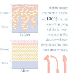 Aparato de <span class=keywords><strong>estética</strong></span> básica de tratamiento de alta frecuencia antienvejecimiento para ablandar la piel, suavizar las arrugas, ajuste de la piel, de alta frecuencia - Product Image 3