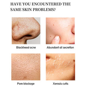 Beste Verkoop 150Ml Natuurlijke Organische Huidverzorging Gezicht Wassen Diepe Schone Porie Olie Controle Super Whitening Kurkuma Gezichtsreiniger - Product Image 2