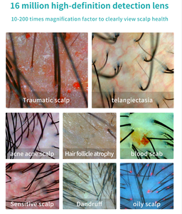Mini microscopio ABS, Analizador de folículos pilosos, Detector, escáner de cuero cabelludo <span class=keywords><strong>para</strong></span> el crecimiento <span class=keywords><strong>del</strong></span> <span class=keywords><strong>cabello</strong></span>, Analizador de Spa capilar - Product Image 6