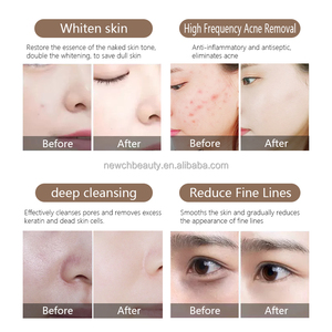 Analizador <span class=keywords><strong>de</strong></span> Piel Portátil Hydro 11 en 1 con IA, Máquina Facial Hydra Beauty para <span class=keywords><strong>Uso</strong></span> Doméstico, Peeling, Spa, Cuidado Facial, Dispositivo <span class=keywords><strong>de</strong></span> Dermoabrasión con Burbujas para Salón - Product Image 4