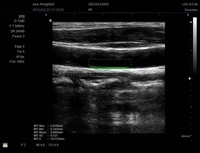 Échographe portable pour centre d'imagerie médicale diagnostique, équipement d'échographie vétérinaire ou humaine