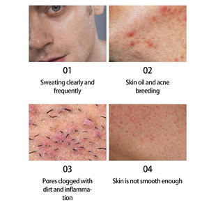 Jabón natural limpiador, exfoliante, hidratante y blanqueador para hombres con aroma a cítricos y romero. - Product Image 2