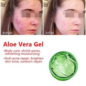 Gel d'<span class=keywords><strong>Aloe</strong></span> <span class=keywords><strong>Vera</strong></span> apaisant pour la peau, prix d'usine, Aloevera <span class=keywords><strong>Forever</strong></span>, pour le visage, fourni par un fabricant de cosmétiques - Product Image 2
