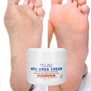 Pieds coudes mains <span class=keywords><strong>crème</strong></span> pour les pieds hydratante en profondeur pieds fissurés secs talons réparation peau morte enlever 40% <span class=keywords><strong>crème</strong></span> d'<span class=keywords><strong>urée</strong></span> - Product Image 2