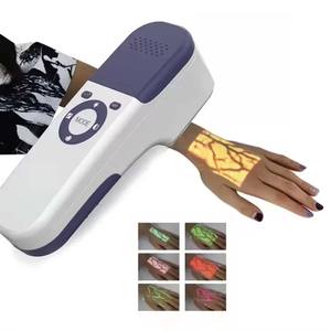 VS-M004 2024 Novos vasos sanguíneos de varredura Equipamento médico Visual Display Body Facial Projeção infravermelha portátil veia <span class=keywords><strong>Finder</strong></span> - Product Image 6