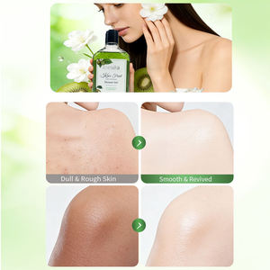 Mascarilla Facial Exfoliante e Iluminadora con Ácidos de Frutas Naturales y Extracto de Kiwi, Marca Privada OEM/ODM, para Todo Tipo de Piel, Femenina - Product Image 3