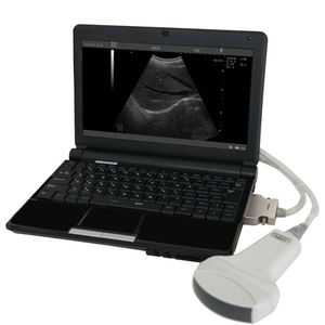 Pemindai <span class=keywords><strong>Ultrasound</strong></span> <span class=keywords><strong>Medison</strong></span>, Pemindai <span class=keywords><strong>Ultrasound</strong></span> Portabel Doppler - Product Image 2