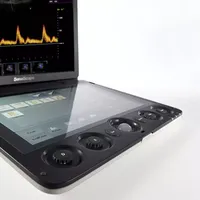 Ecógrafo Médico Portátil 3D 4D, Promoción Sonoscape S9