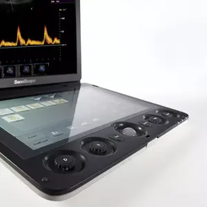 Echography medis mesin Ultrasound portabel 3D 4D Promosi sonosape S9 - Product Image 5