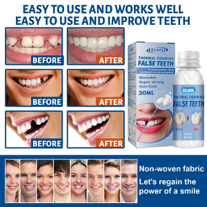 EELHOE DIY Thermal Forming False Teeth Party <b>Denture</b> Modificating Tooth Gap Filling Reusable Super Strong Shapeable Gutta Percha - Product Image 4
