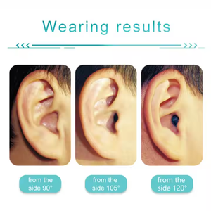 เครื่องช่วยฟัง AcoSound Patent 8-Channel 100% แบบซ่อนในรูหู ปรับแต่งได้ สำหรับเยาวชน ขนาดเล็กกว่า รุ่น Deaf Ruby IIC ผลิตภัณฑ์สำหรับหูและระบบการได้ยิน - Product Image 6