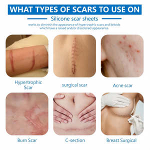 Silicone Sẹo Sheets Hiệu Quả Sẹo Loại Bỏ Băng Vá Cho New Sẹo 1.57 ''X 2.95'' - Product Image 3