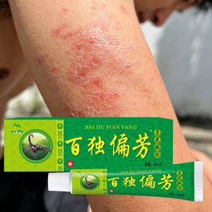 Crema herbaria anti-picazón al por mayor de fabricantes, adecuada para dermatitis, tiña, picaduras de mosquitos, <span class=keywords><strong>ampollas</strong></span> <span class=keywords><strong>en</strong></span> <span class=keywords><strong>la</strong></span> <span class=keywords><strong>piel</strong></span> - Product Image 1