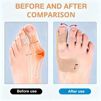Bande de kinésiologie pour la correction des hallux valgus - Élastique, respirante et hypoallergénique, sans latex, bandes de soutien pour les orteils