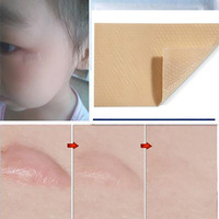 Autocollant médical souple anti-acné, 1 pièce, cache les cicatrices, bande réparatrice, étanche, pratique, bon genre de peau