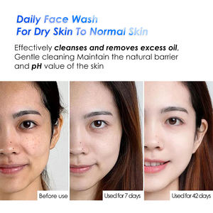 Limpiador Facial de Bajo pH, Hidratante, con Aminoácidos, Limpiador Facial de Marca Blanca, Limpiador Facial Espumoso con Aceite - Product Image 6