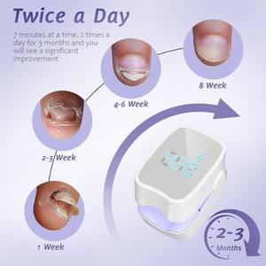 Dispositivo laser Showell SMD-79 per il trattamento della micotica delle unghie con luce LED e 35 LED per uso domestico, per onicomicosi delle unghie dei piedi. - Product Image 2