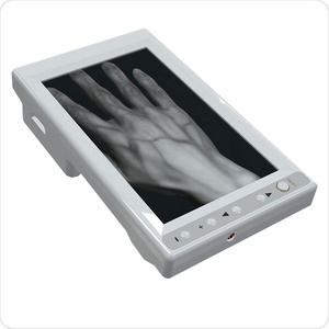 2025 giá thấp y tế tĩnh mạch Finder di động cầm tay Scanner tĩnh mạch Viewer thú y Máy dò với hộp - Product Image 1