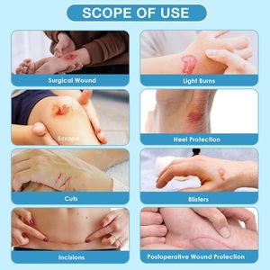 YOJO - Rollo de Parches Hidrocoloides Autoadhesivos, Personalizables en Tamaño y Forma, Esterilizados con Óxido de Etileno, Certificados por la CE, para el Cuidado de Heridas, Quemaduras y Ampollas - Product Image 4