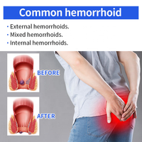 Crème pour les soins des hémorroïdes à base d'extraits végétaux antibactériens ZongYiTang ZYT-01 pour adultes, peau normale, usage corporel