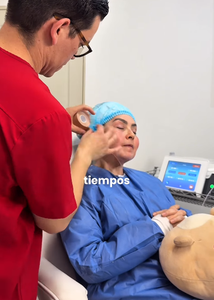 Endolifting, Resultados de Piel Firme, Tratamientos Estéticos con Láser, Láser de Diodo 980 1470, Endoláser, Lipo, Papada - Product Image 3