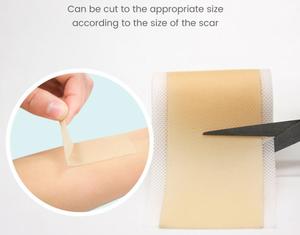 Cinta de Gel de Silicona para Eliminar Cicatrices, Rollo de Adhesivo Médico para Recuperación de Cesárea, Apósito Autoadhesivo para <span class=keywords><strong>Heridas</strong></span> - Product Image 4