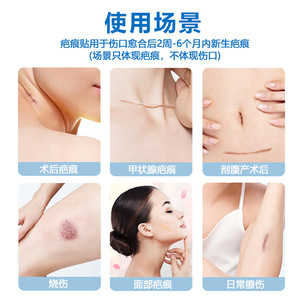 Move Silicone Scar Patch 10cm X 2.5cm For Scar Repair And Fading All Skin Types Body Patches - Product Image 2