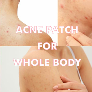 Cubierta absorbente Punto de imperfecciones para zits imperfecciones puntos blancos hidrocoloide Acné Parche de espinillas - Product Image 4