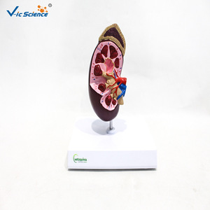 Modèle d'anatomie du rein humain ; structure vasculaire en coupe transversale du rein ; outil pédagogique et de formation en urologie médicale. - Product Image 4