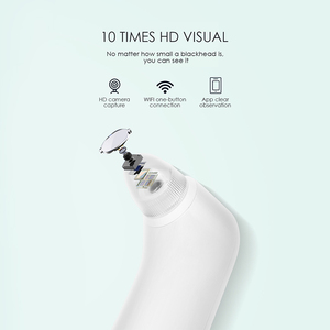 KSKIN KD802P - Removedor Eléctrico de Puntos Negros, Limpiador de Poros al Vacío, 3 Niveles de Succión, 4 Cabezales, Ampliación HD 10x, Uso Manual en el Rostro - Product Image 2