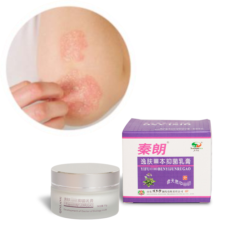 Factory Wholesale Natural Extract Skin Ointment Mild and Non-Stimulating Psoriasis Ointment for Body Skincare