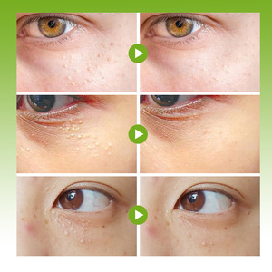 Crème Contour des Yeux Bio aux Herbes Vitamine C & E Réduction des Poches Anti-Rides Anti-Gonflements Nourrissante Élimination des Granules de Vitamine E - Product Image 4