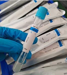 Minicentrífuga de Laboratorio Médico, Bomba Centrífuga Pequeña, Kit de Tubos de 15 ml, Precio Clínico - Product Image 6