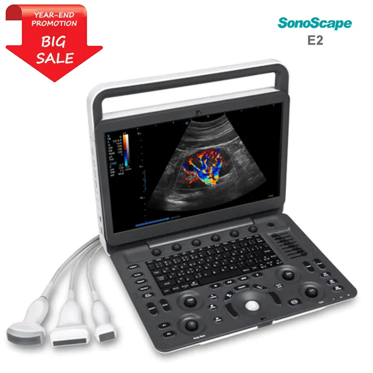 Высокое качество 15,6 дюймов Sonoscape E2 Высокое разрешение цветной допплер ультразвуковой аппарат