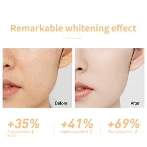 LANBENA New Arrivals Niacinamide Antioxidant Skin Lightening Plumping Face <strong>Moisturizer</strong> - Product Image 4