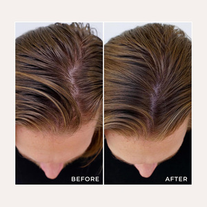 <span class=keywords><strong>Shampoo</strong></span> a <span class=keywords><strong>secco</strong></span> organico in polvere olio volumizzante che assorbe <span class=keywords><strong>capelli</strong></span> chiari <span class=keywords><strong>scuri</strong></span> Non Aerosol nessun residuo sicuro per le estensioni di casa - Product Image 6